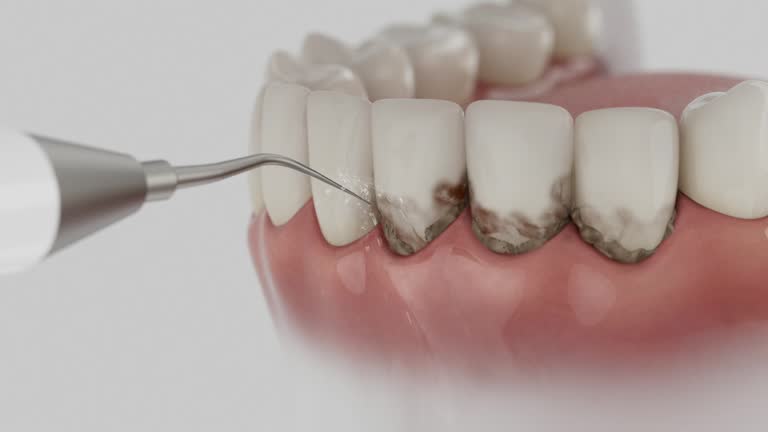 Trusted Teeth Cleaning And Checkup service in Country Club Hills, IL - Dentist Open Now
